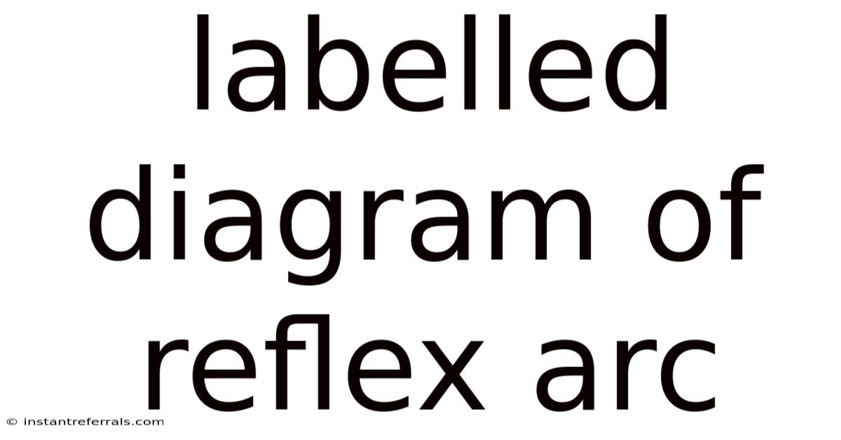 Labelled Diagram Of Reflex Arc